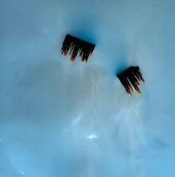 Eyelashes defect example